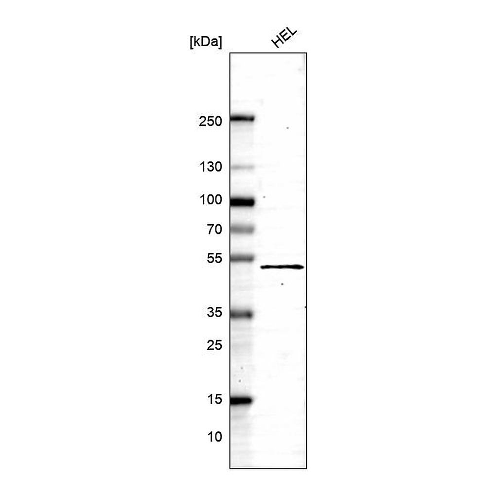 Atlas Antibodies Anti-DSCC1 Antibody