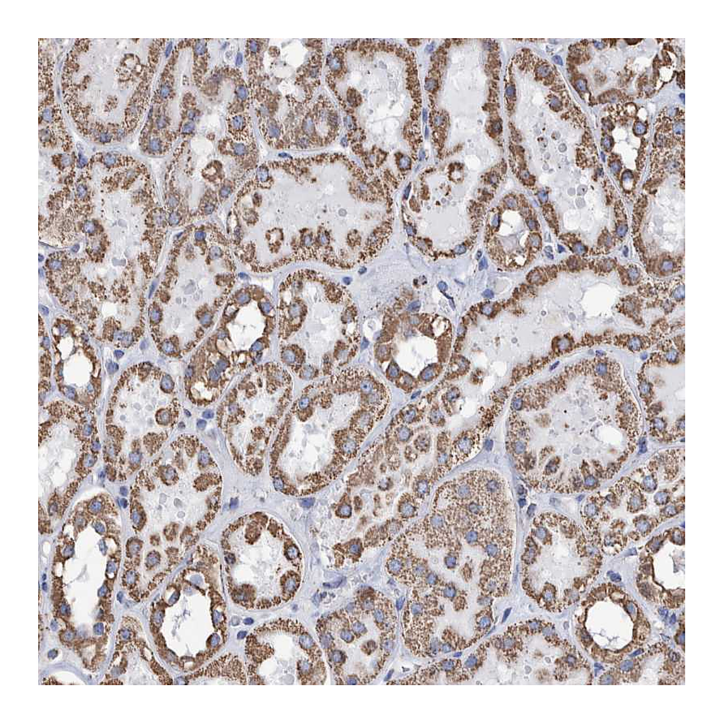 Atlas Antibodies Anti-DSCR3 Antibody