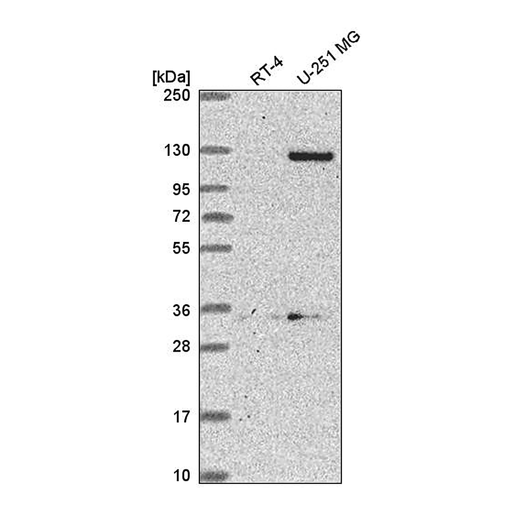 Atlas Antibodies Anti-DSEL Antibody