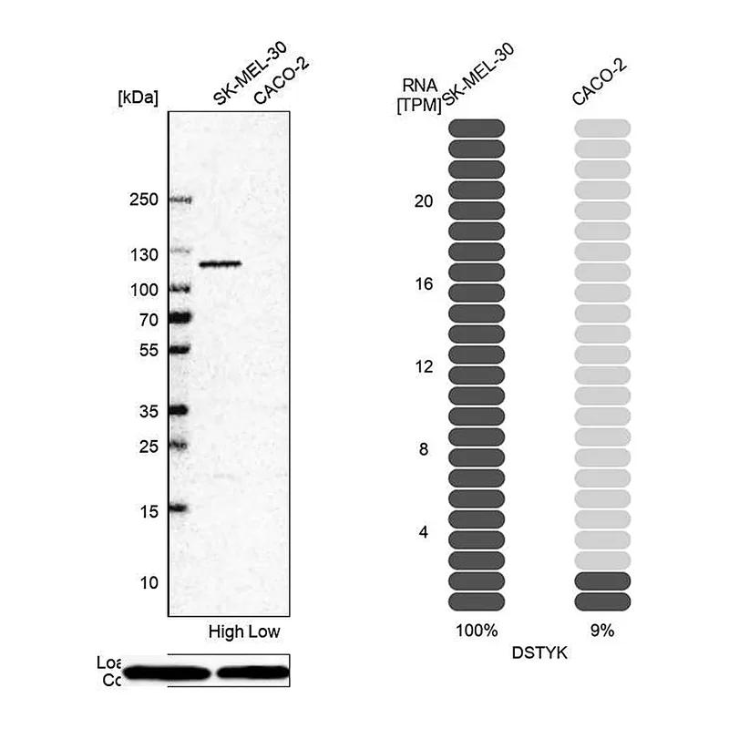 Atlas Antibodies Anti-DSTYK Antibody