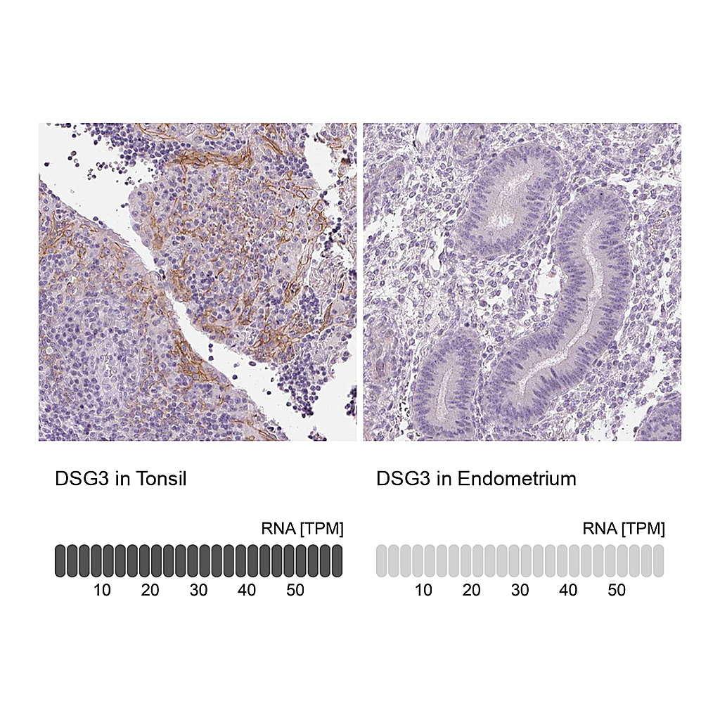 Atlas Antibodies Anti-DSG3 Antibody
