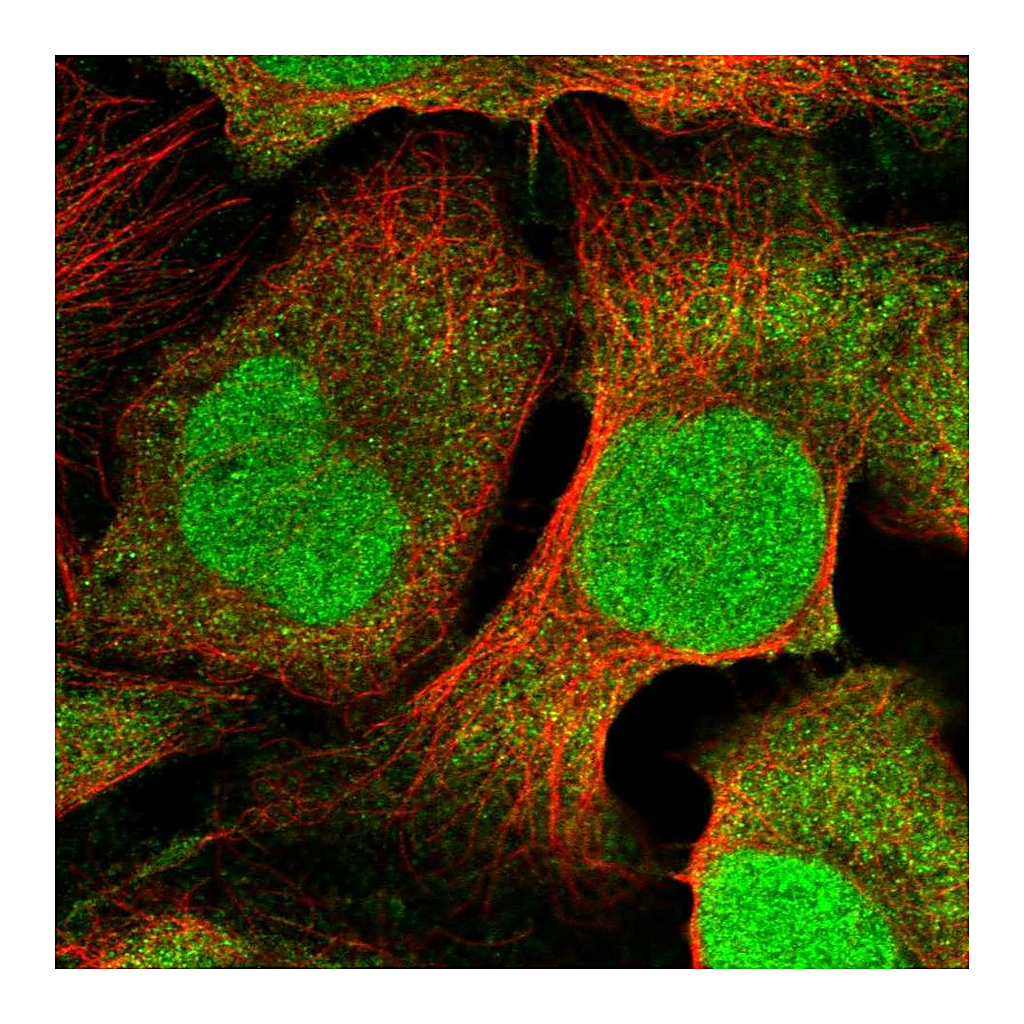Atlas Antibodies Anti-DTL Antibody
