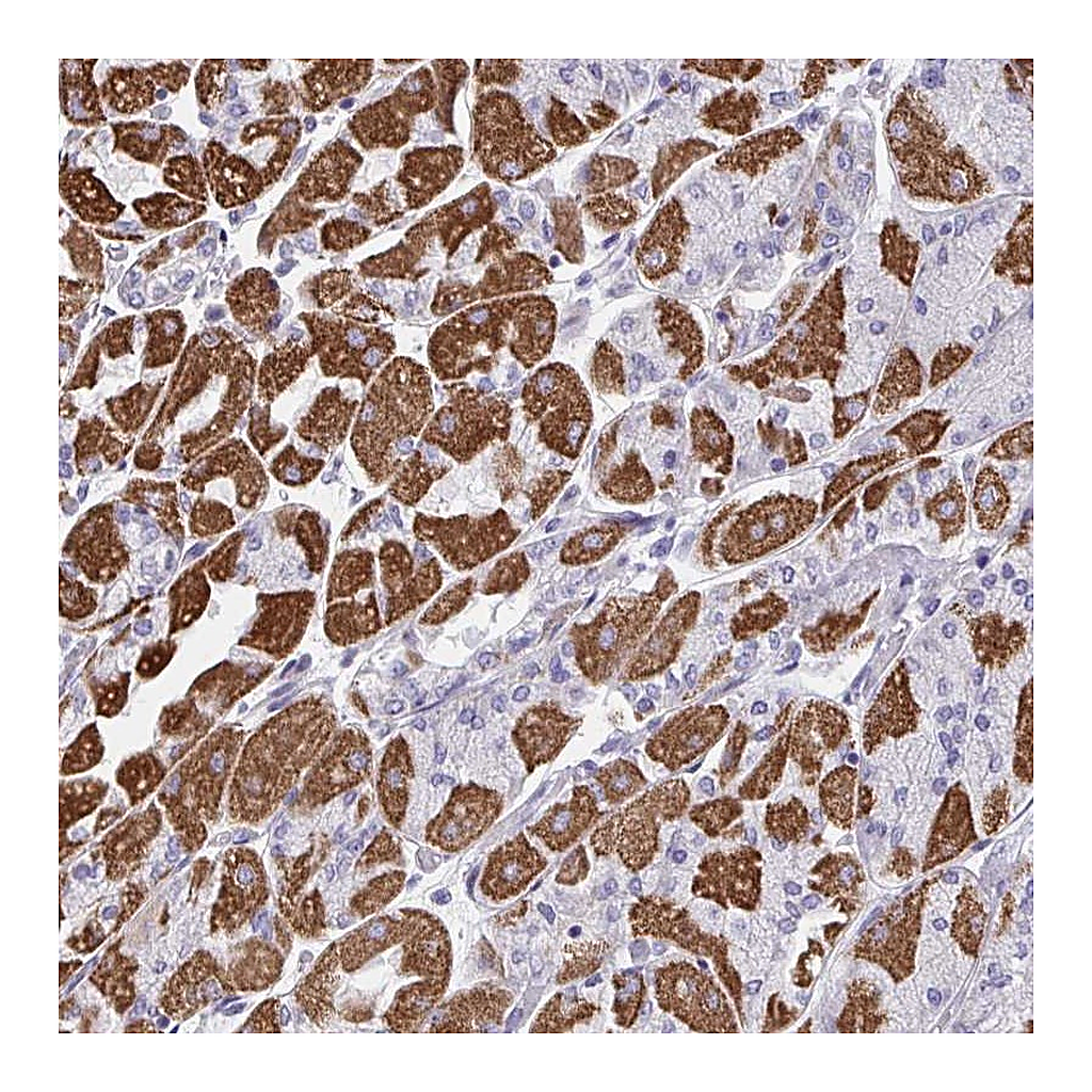Atlas Antibodies Anti-DTX3 Antibody