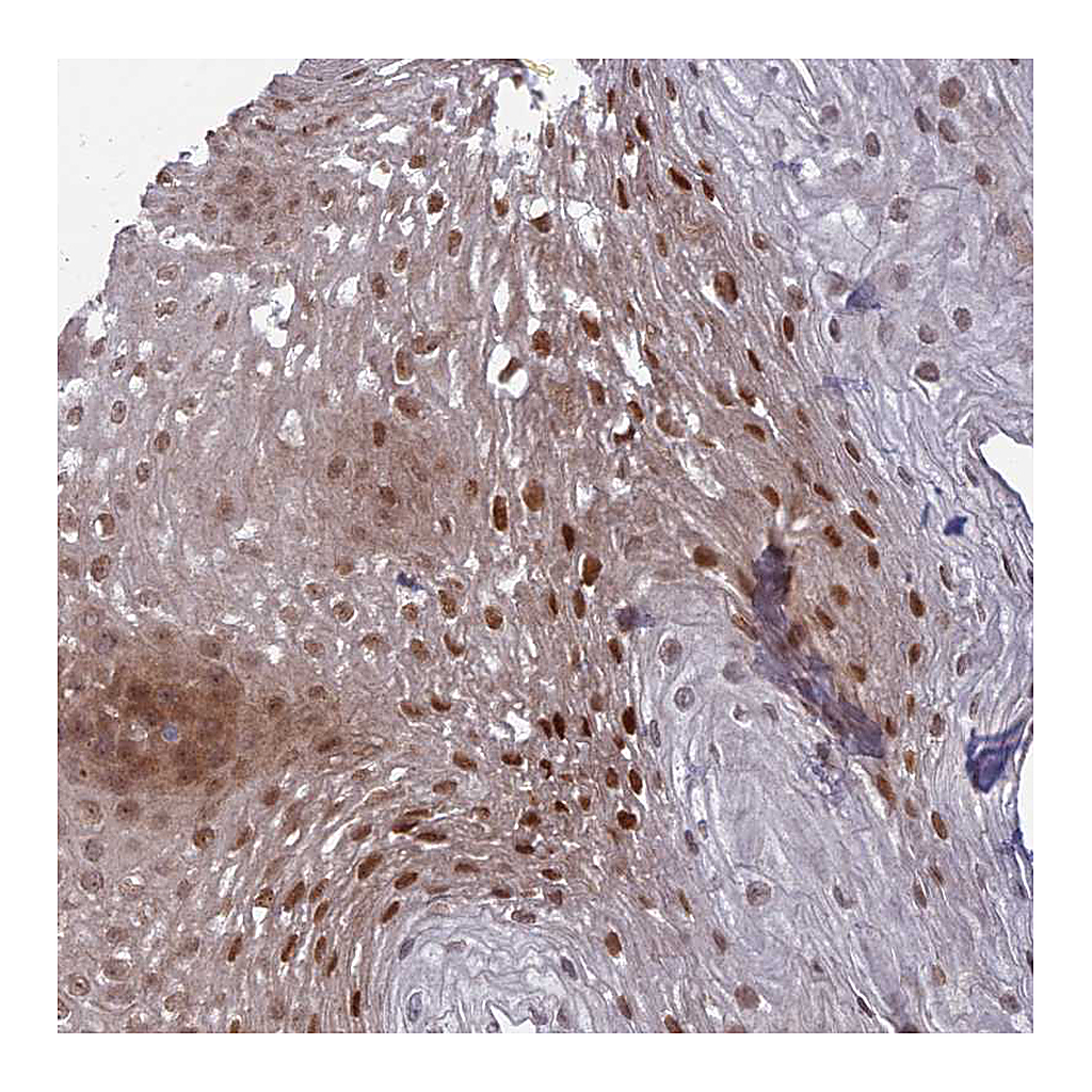 Atlas Antibodies Anti-DTX2 Antibody