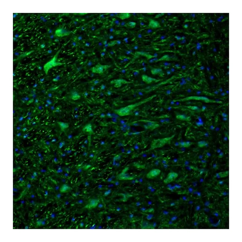Atlas Antibodies Anti-DTX4 Antibody