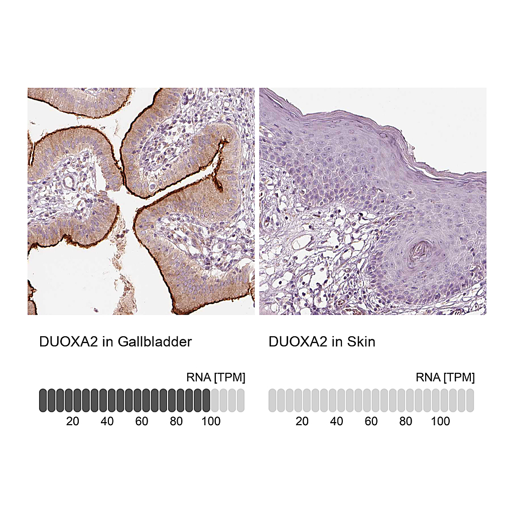 Atlas Antibodies Anti-DUOXA2 Antibody