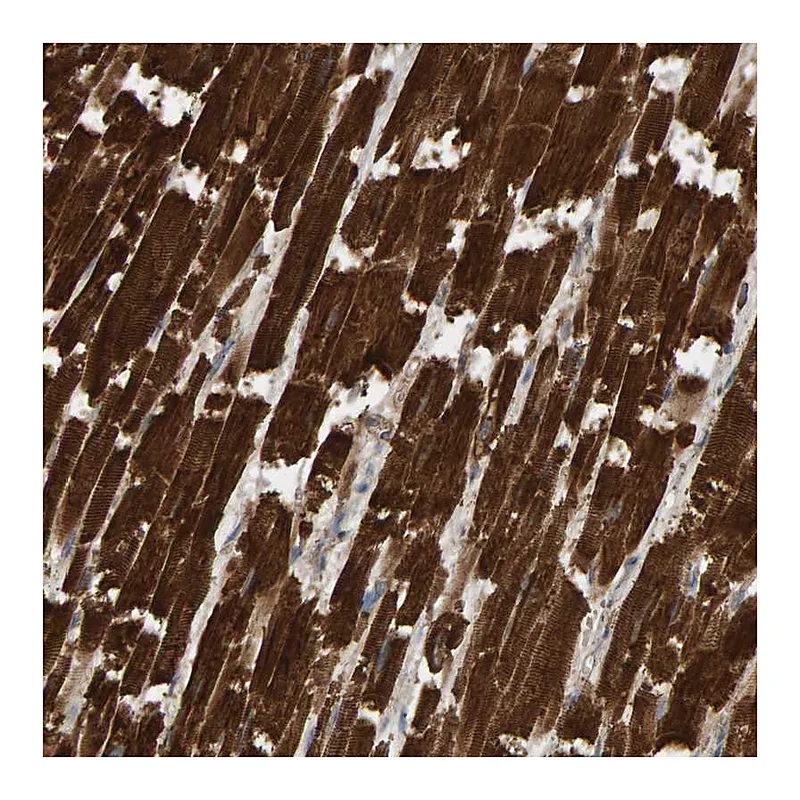 Atlas Antibodies Anti-DUS1L Antibody