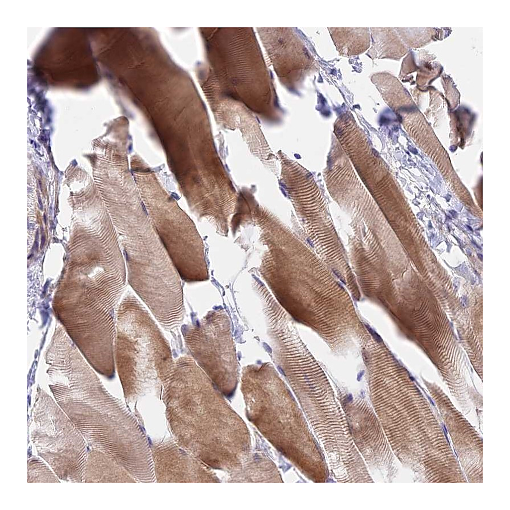 Atlas Antibodies Anti-DUPD1 Antibody