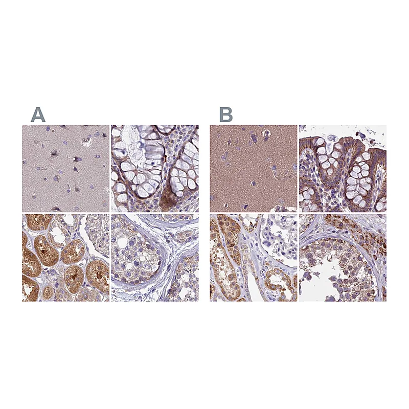 Atlas Antibodies Anti-DUS2 Antibody