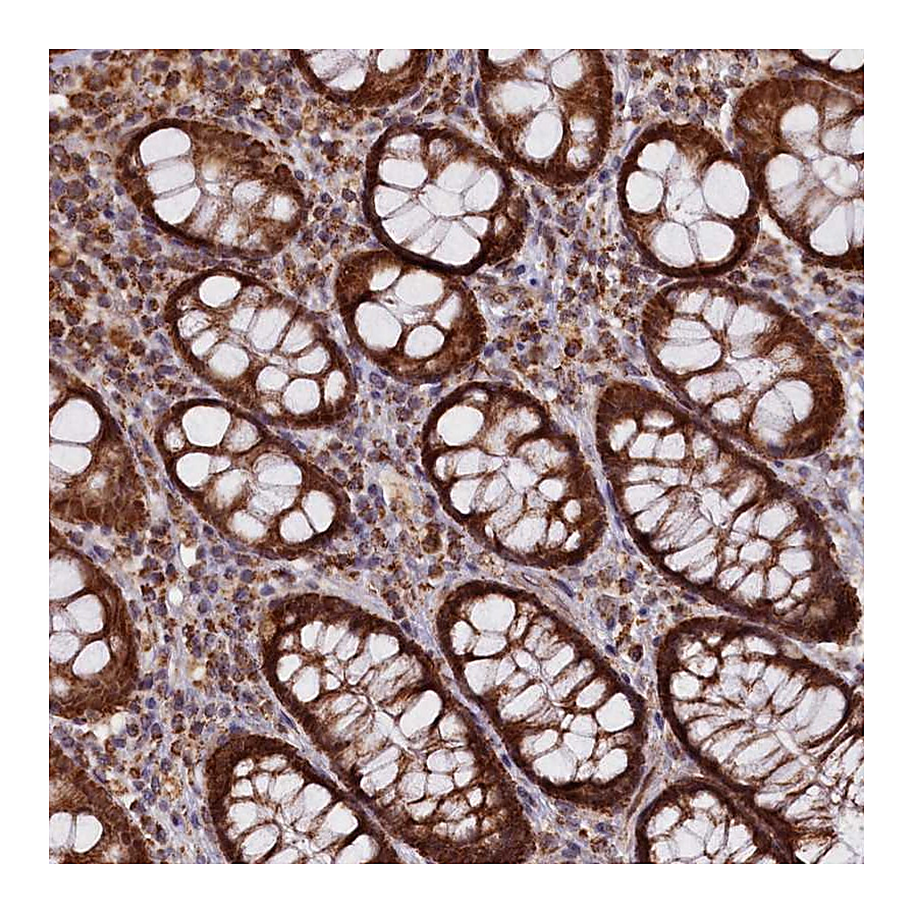 Atlas Antibodies Anti-DUS3L Antibody