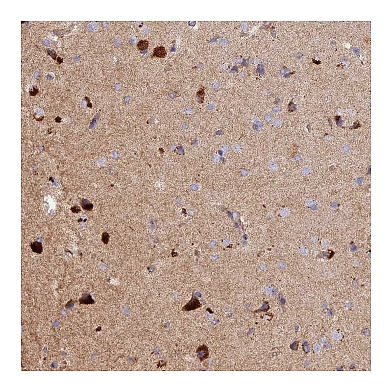 Atlas Antibodies Anti-DUS3L Antibody