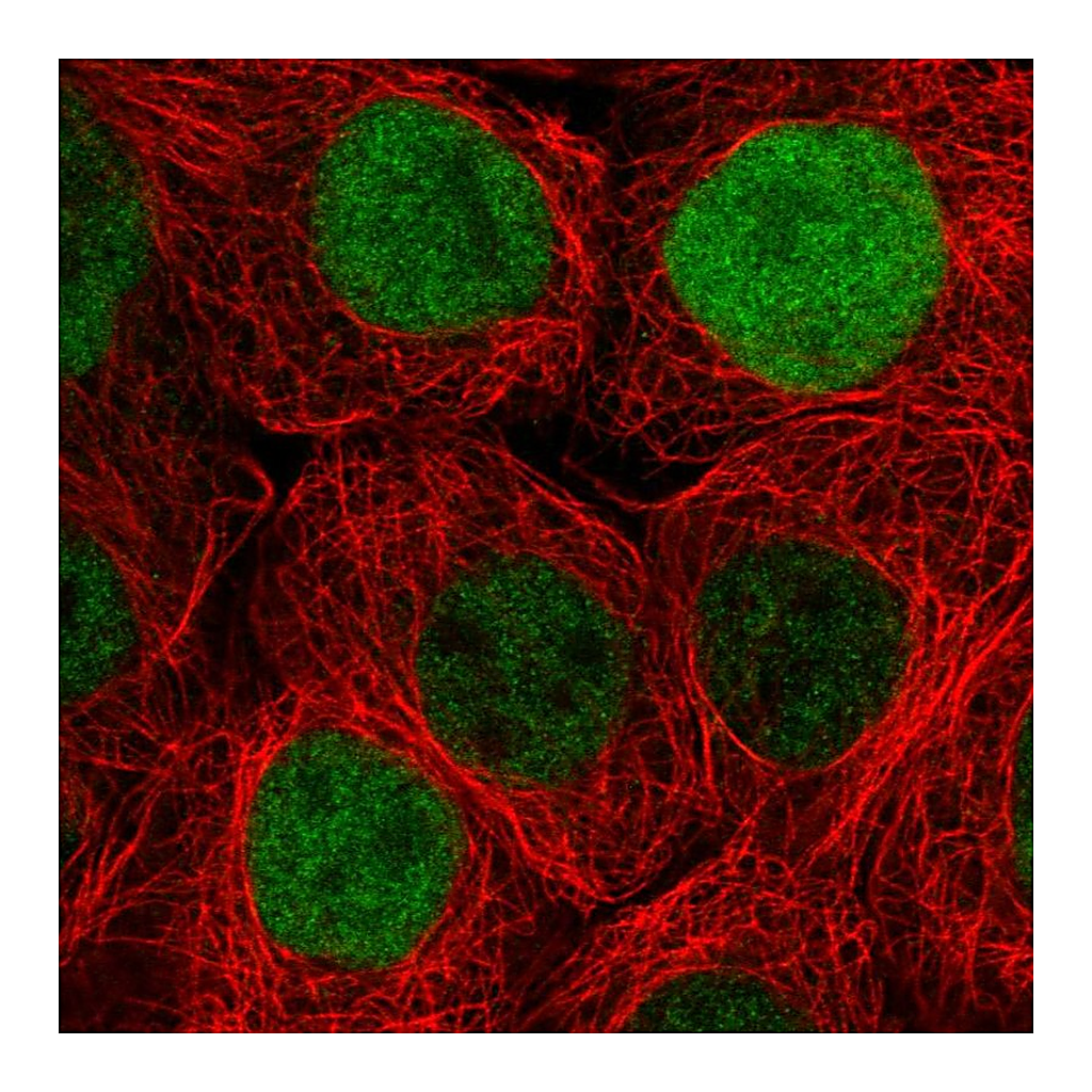 Atlas Antibodies Anti-DUSP18 Antibody