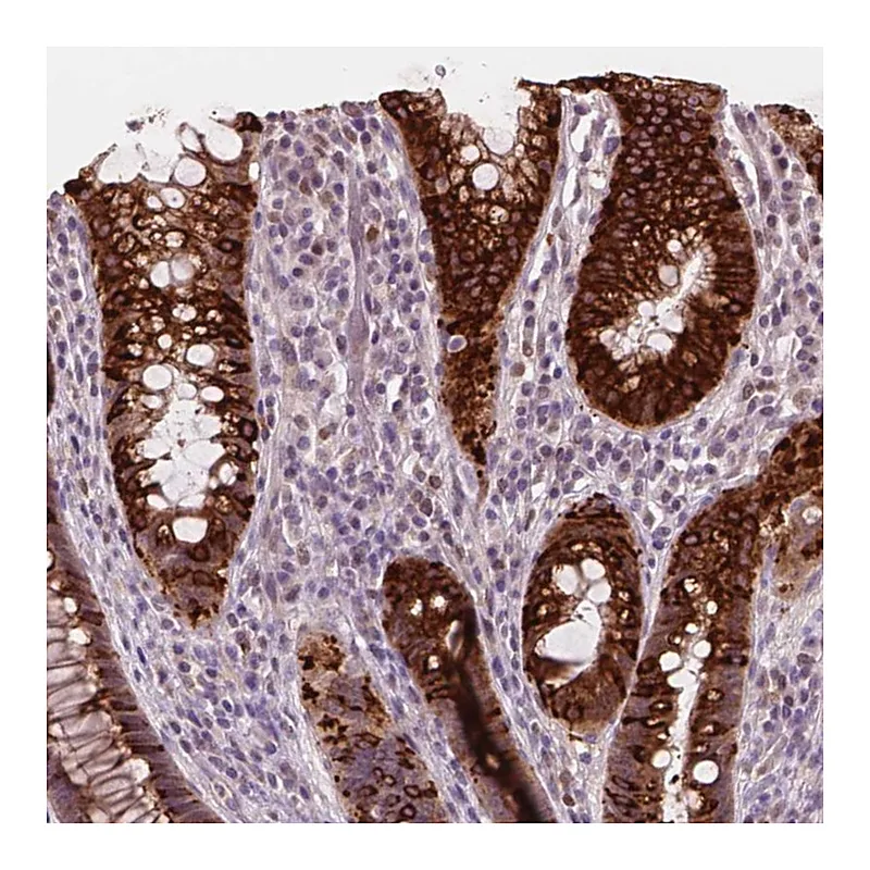 Atlas Antibodies Anti-DUSP16 Antibody