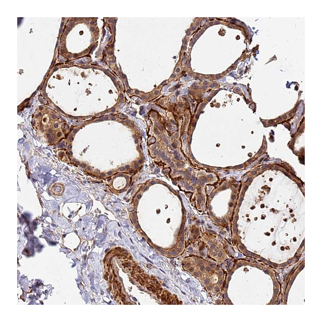 Atlas Antibodies Anti-DUS4L Antibody