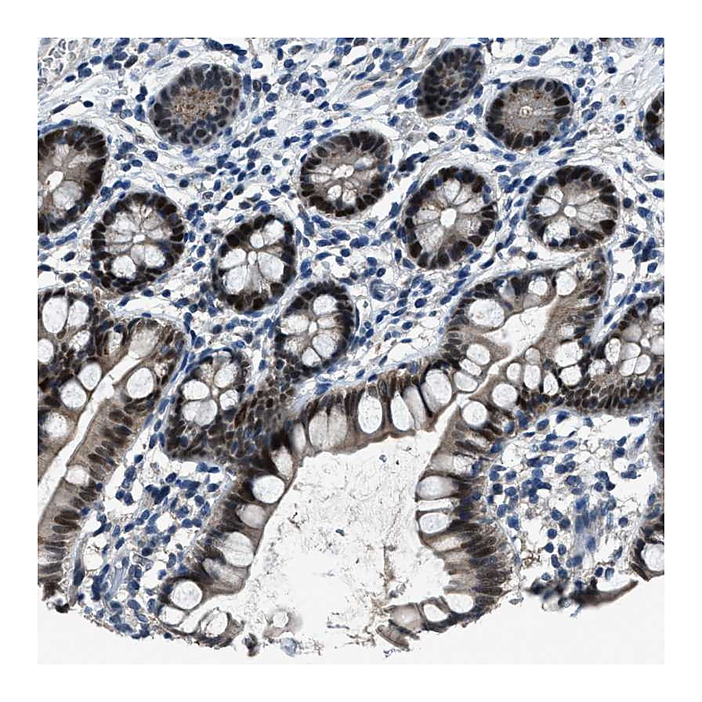 Atlas Antibodies Anti-DUSP19 Antibody