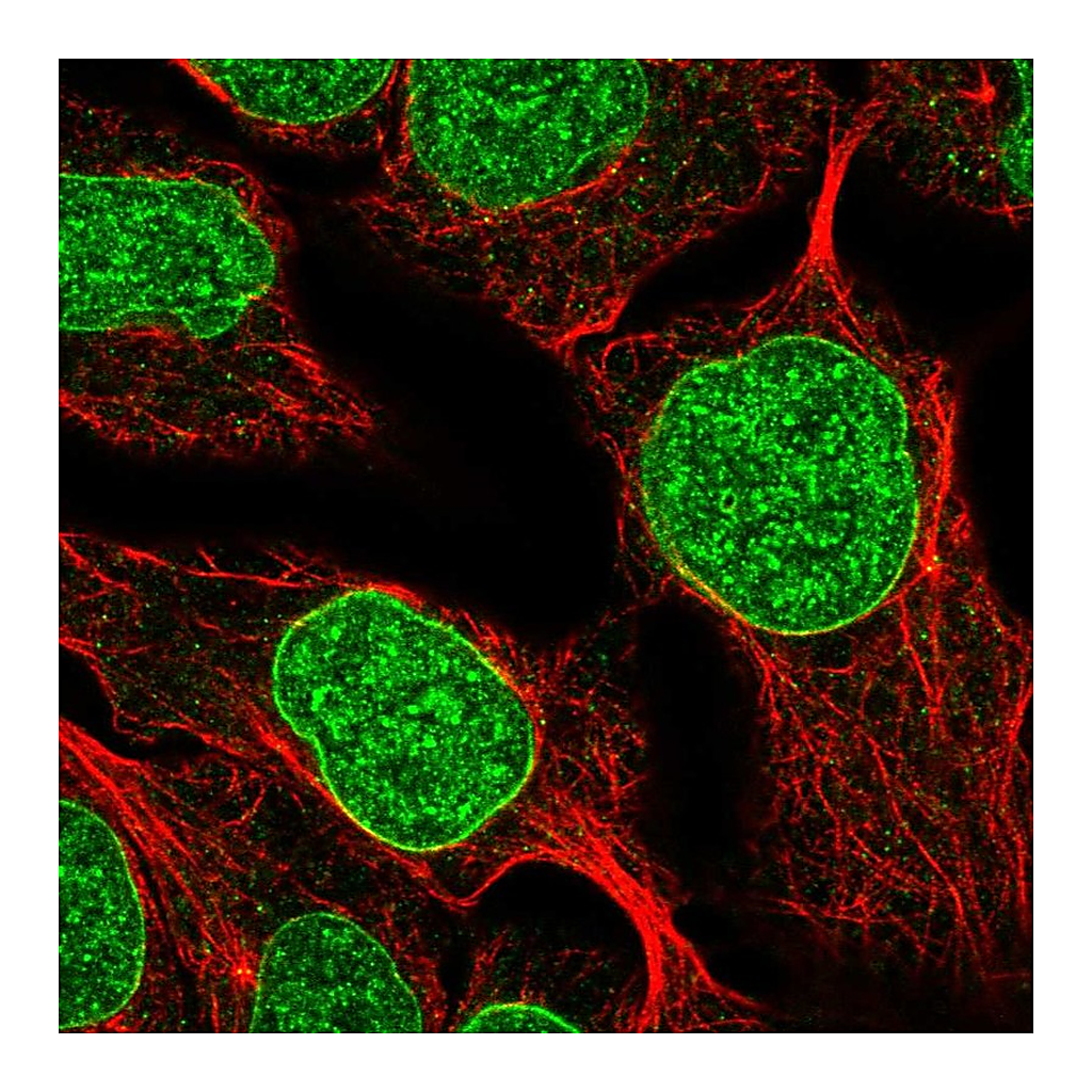 Atlas Antibodies Anti-DUSP2 Antibody