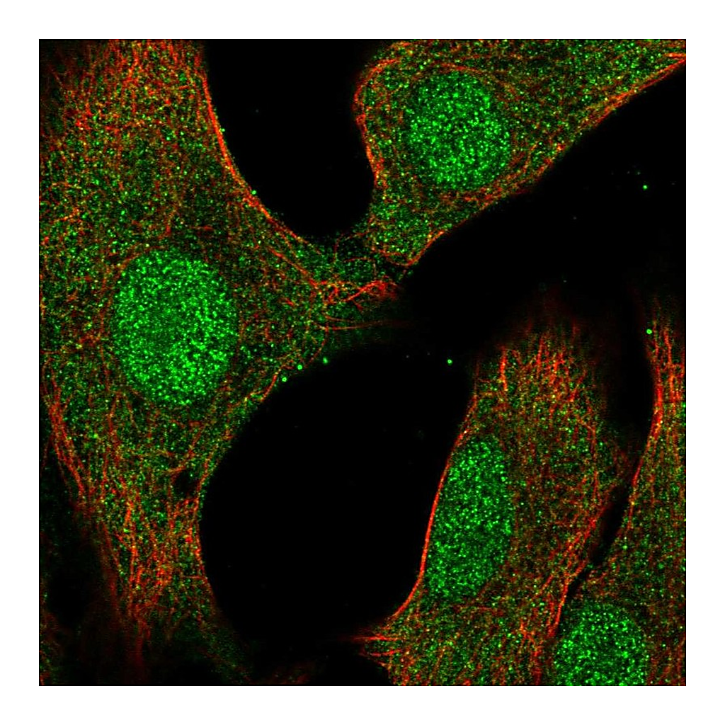 Atlas Antibodies Anti-DUSP3 Antibody
