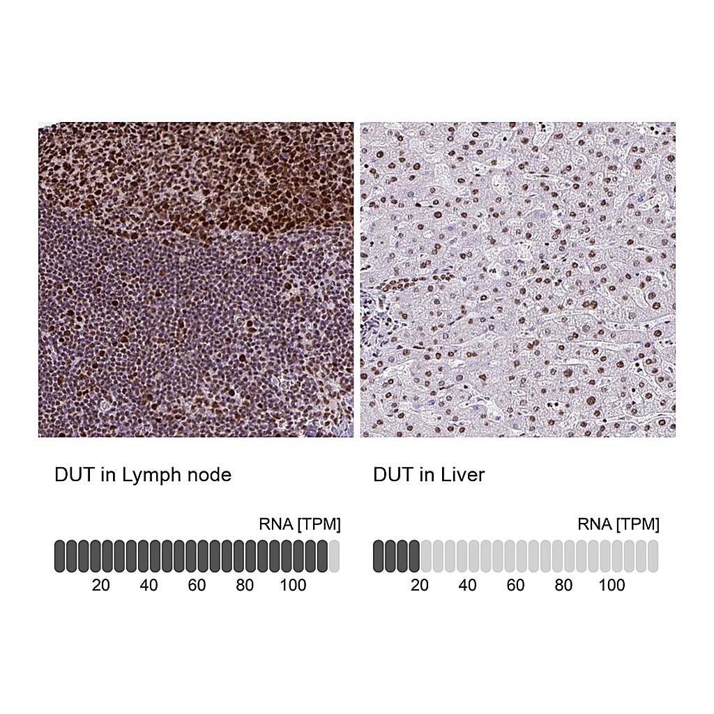 Atlas Antibodies Anti-DUT Antibody