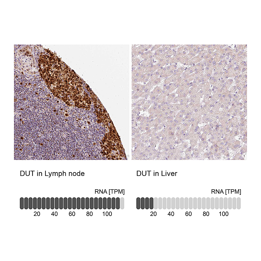 Atlas Antibodies Anti-DUT Antibody