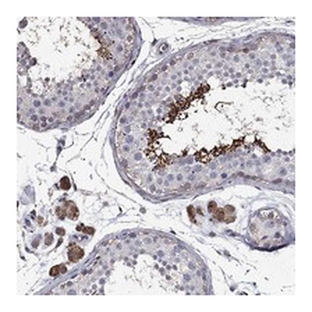 Atlas Antibodies Anti-DVL1 Antibody