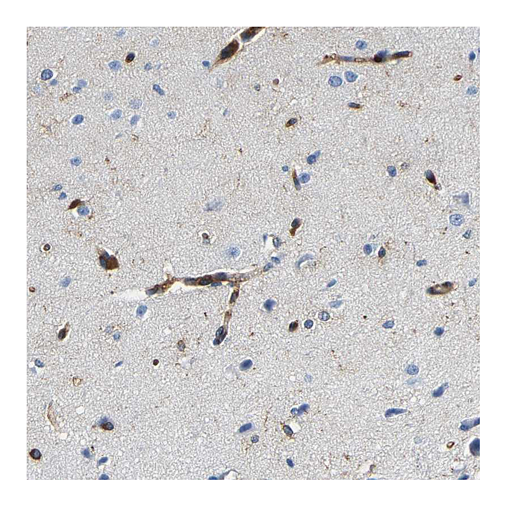 Atlas Antibodies Anti-DUSP8 Antibody