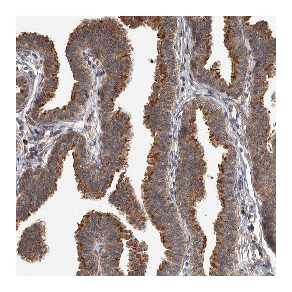 Atlas Antibodies Anti-DVL2 Antibody
