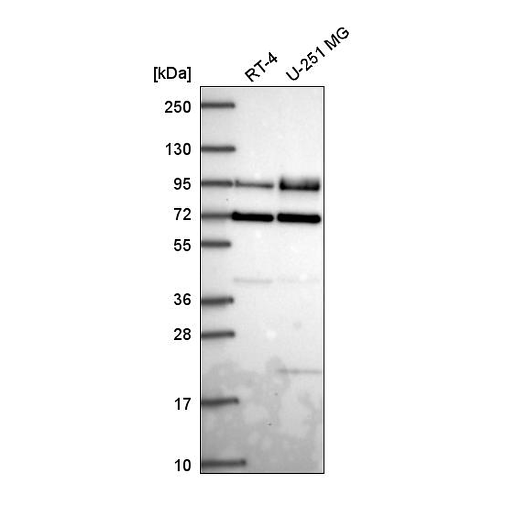 Atlas Antibodies Anti-DVL2 Antibody