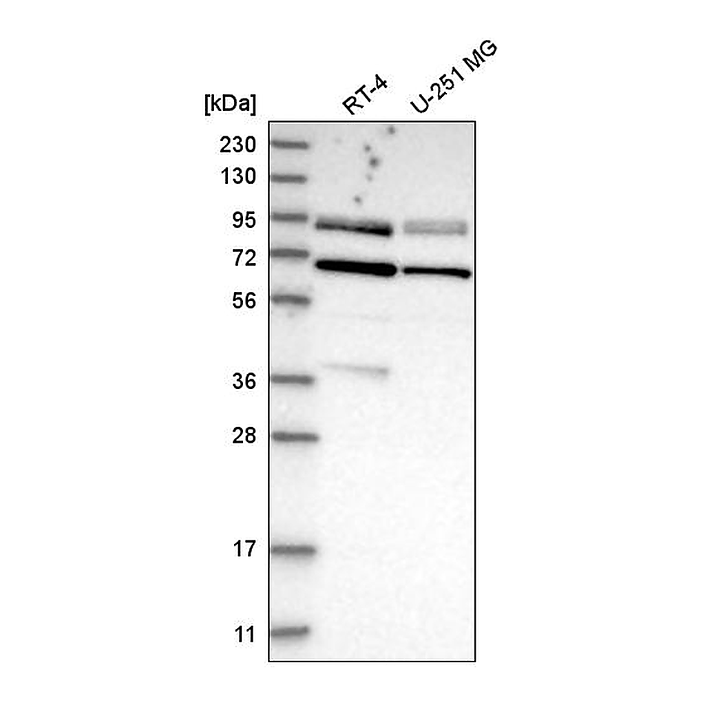 Atlas Antibodies Anti-DVL2 Antibody