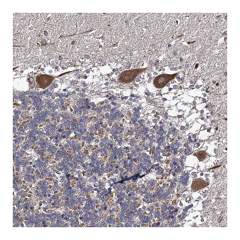 Atlas Antibodies Anti-DYDC1 Antibody