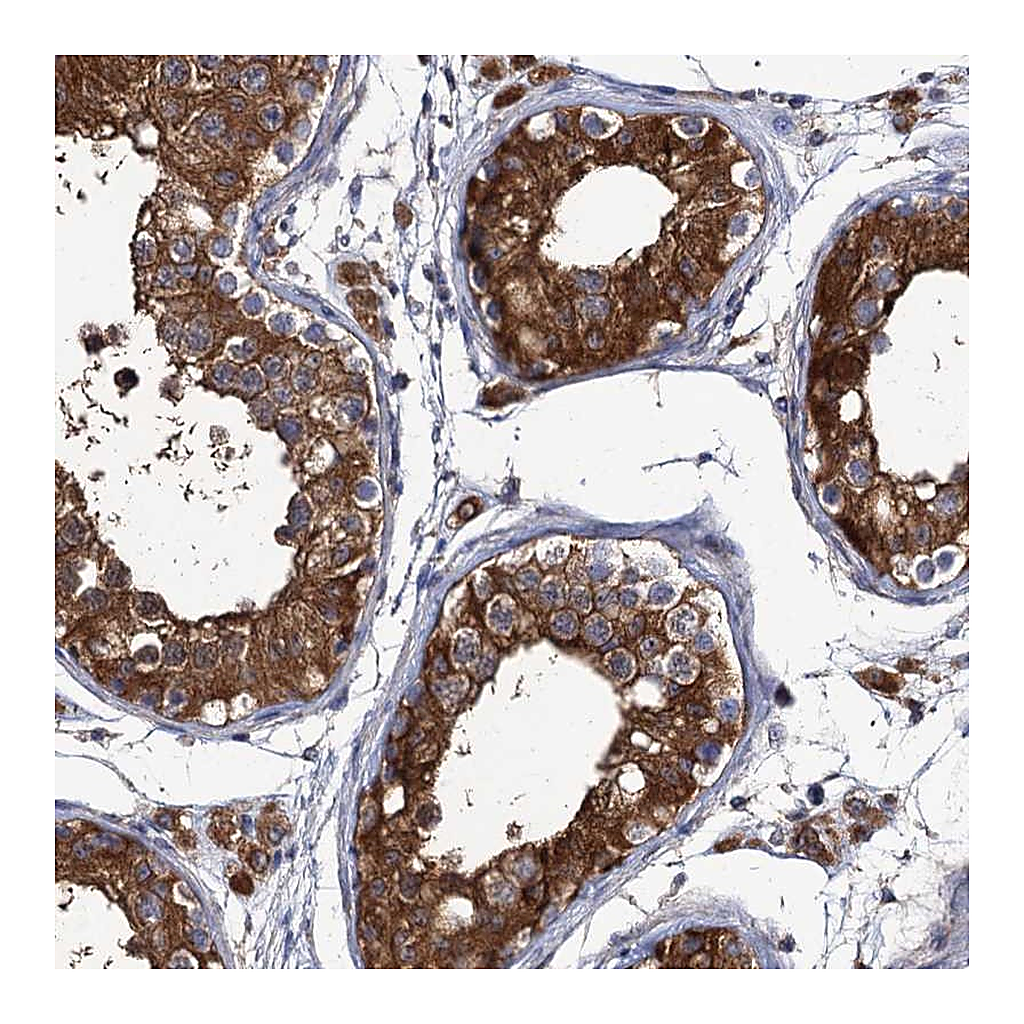 Atlas Antibodies Anti-DYDC1 Antibody