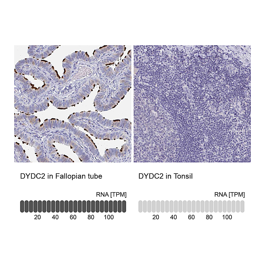Atlas Antibodies Anti-DYDC2 Antibody
