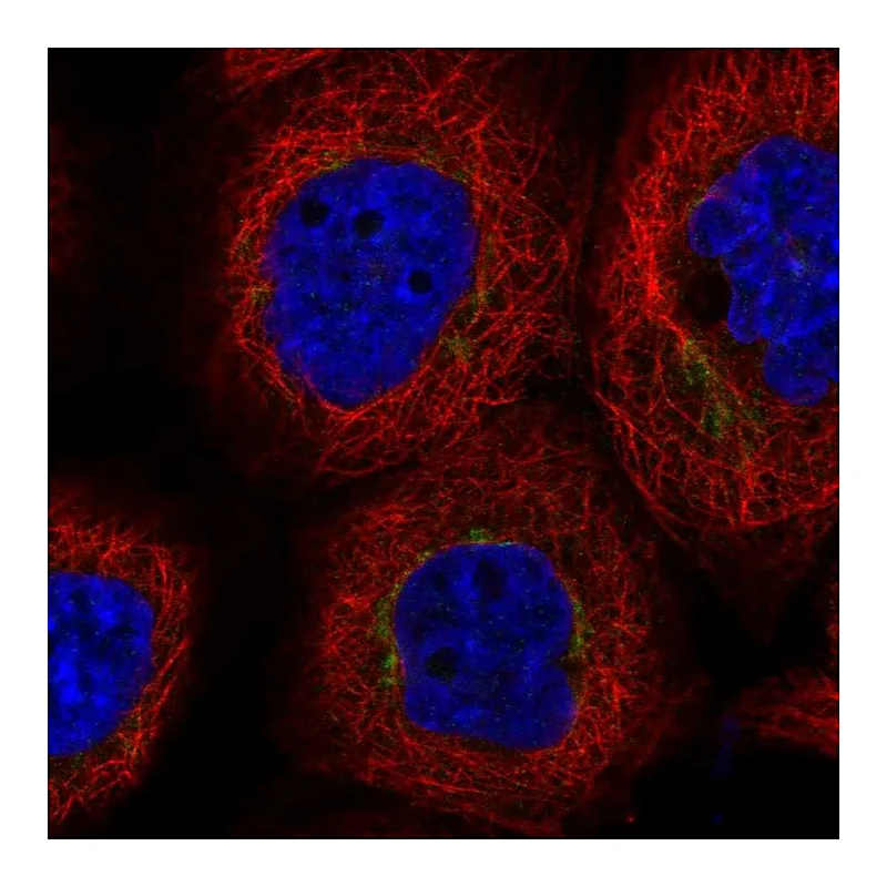 Atlas Antibodies Anti-DYM Antibody