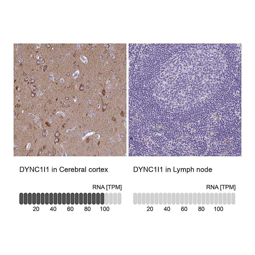 Atlas Antibodies Anti-DYNC1I1 Antibody