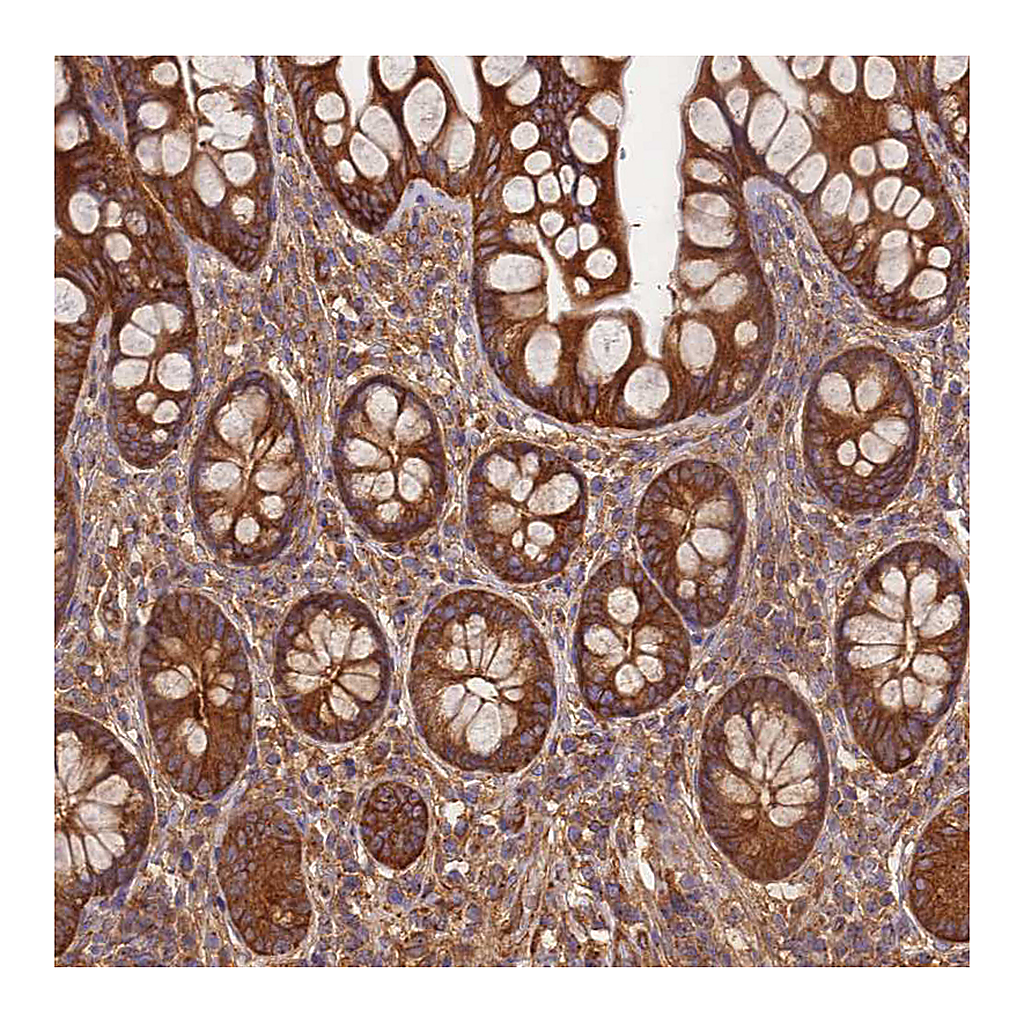 Atlas Antibodies Anti-DYNC1I2 Antibody