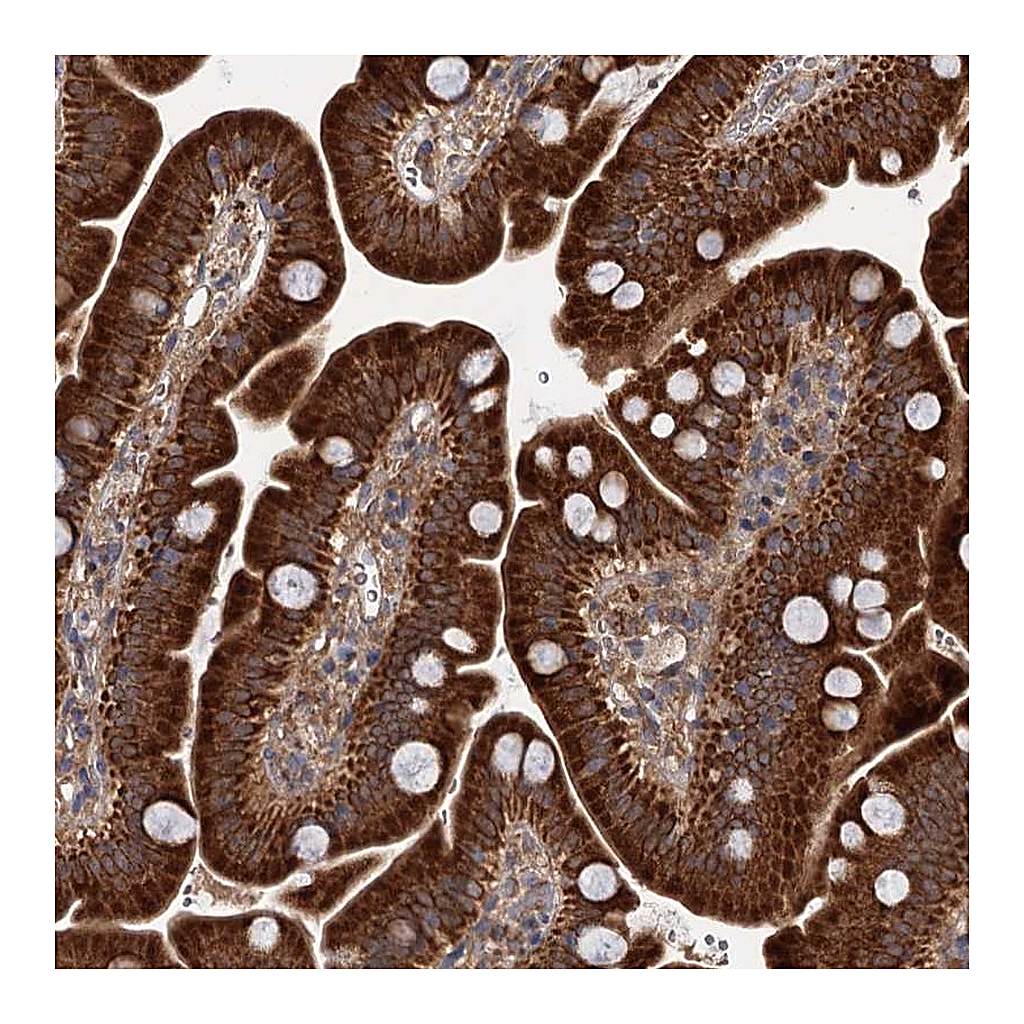 Atlas Antibodies Anti-DYNC2H1 Antibody