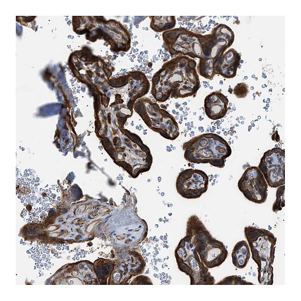 Atlas Antibodies Anti-DYRK1A Antibody