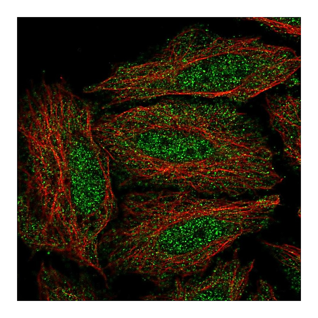 Atlas Antibodies Anti-DYRK3 Antibody