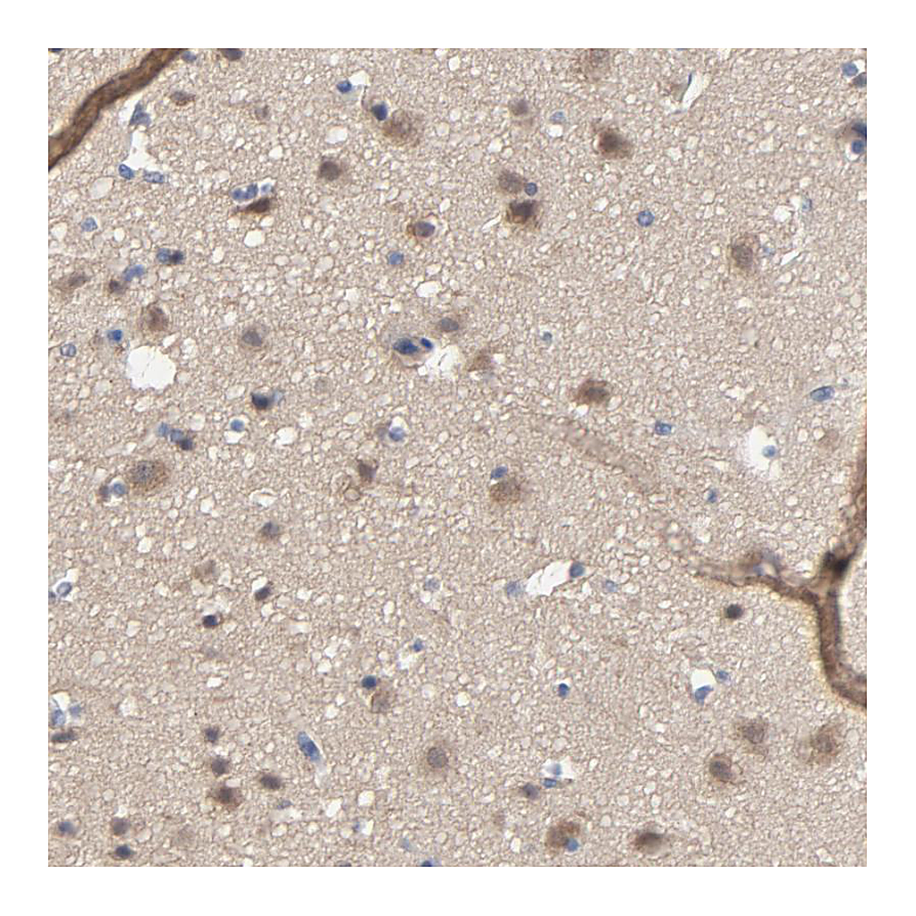 Atlas Antibodies Anti-DYNLT3 Antibody