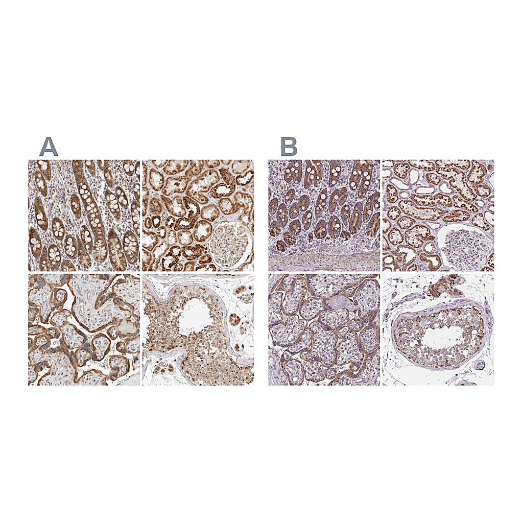 Atlas Antibodies Anti-DYRK4 Antibody