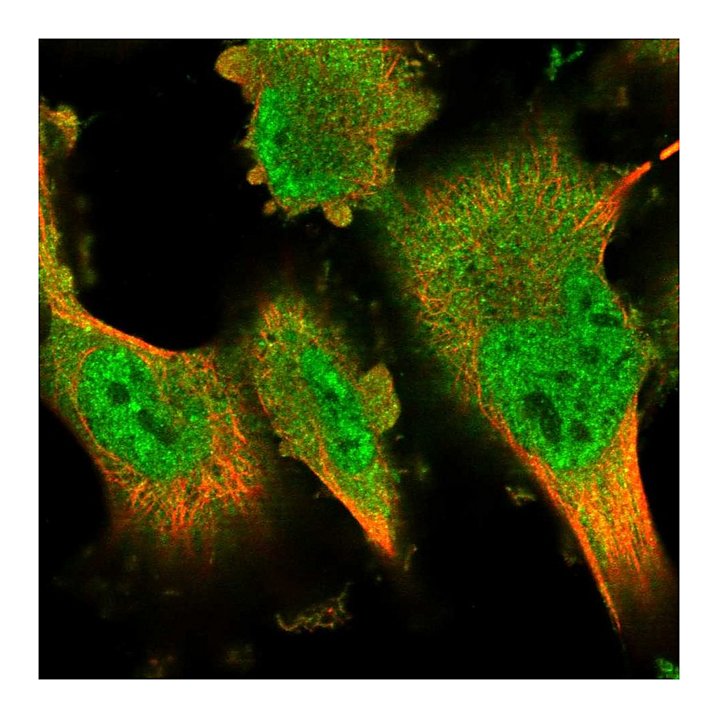 Atlas Antibodies Anti-DYRK2 Antibody