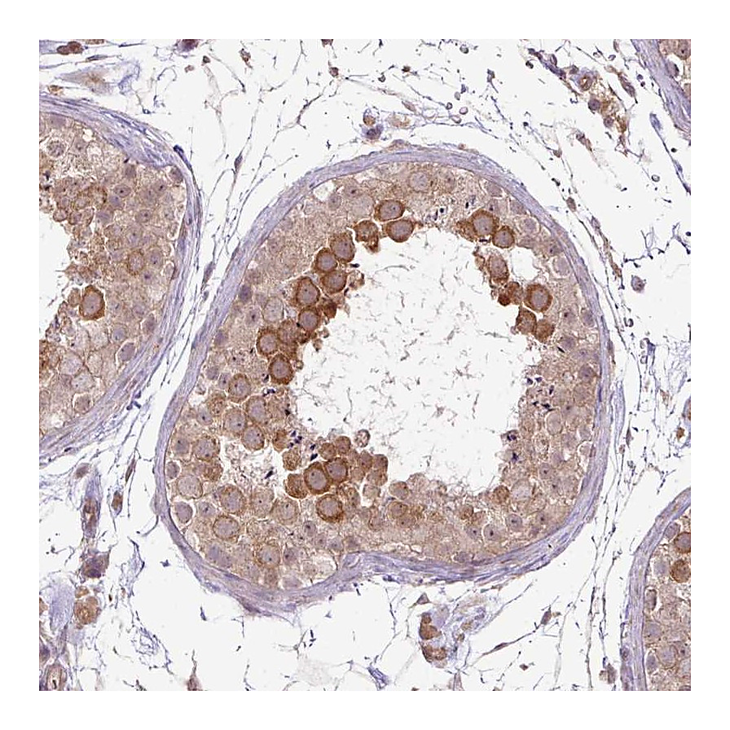 Atlas Antibodies Anti-DYX1C1 Antibody