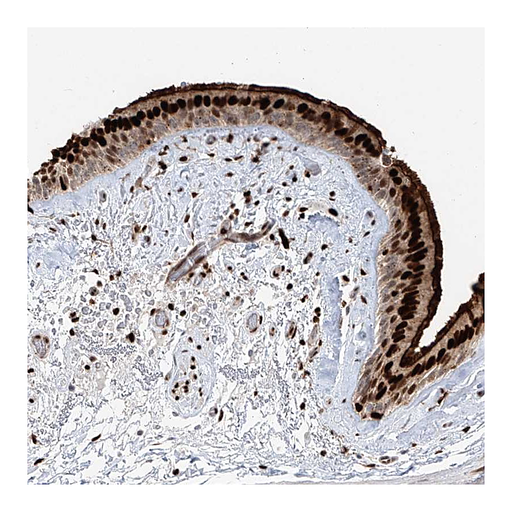 Atlas Antibodies Anti-DZIP1L Antibody