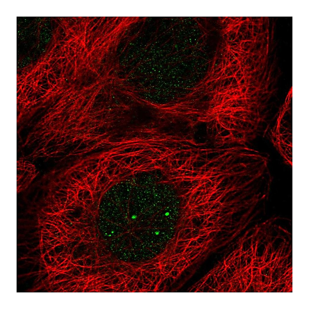 Atlas Antibodies Anti-E2F5 Antibody