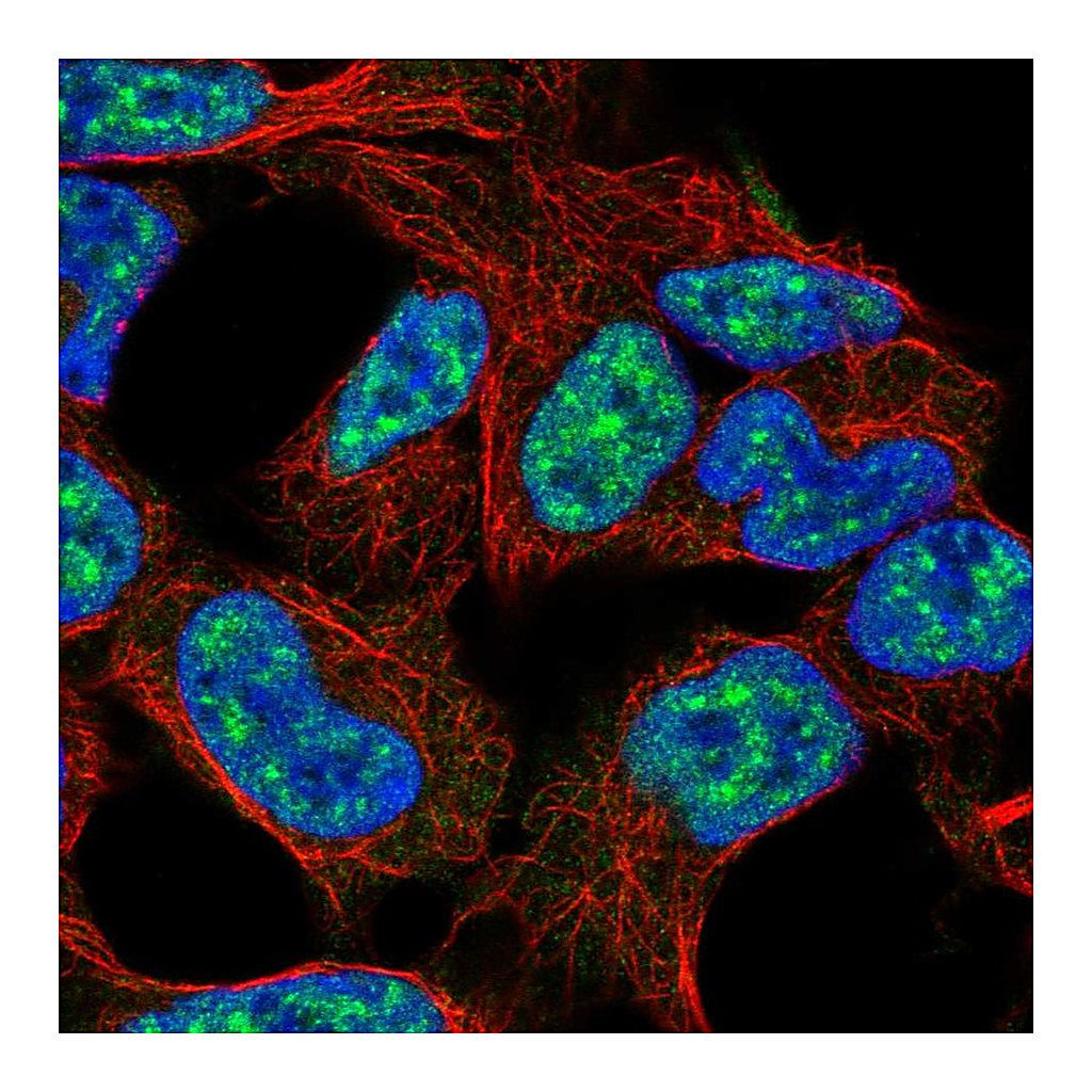 Atlas Antibodies Anti-E2F3 Antibody