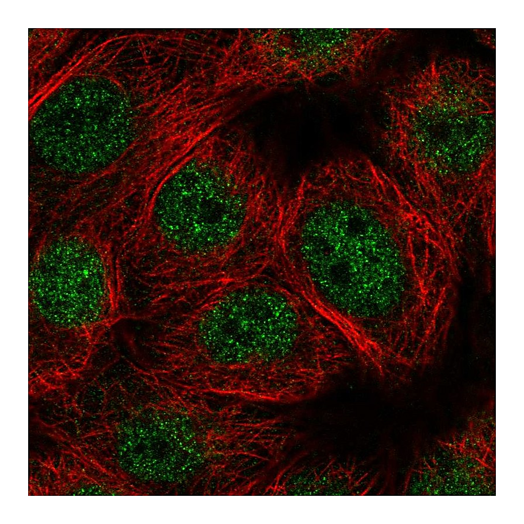 Atlas Antibodies Anti-E4F1 Antibody