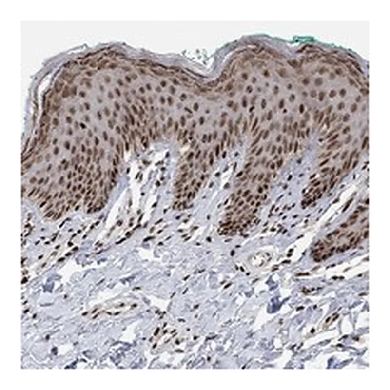 Atlas Antibodies Anti-E4F1 Antibody