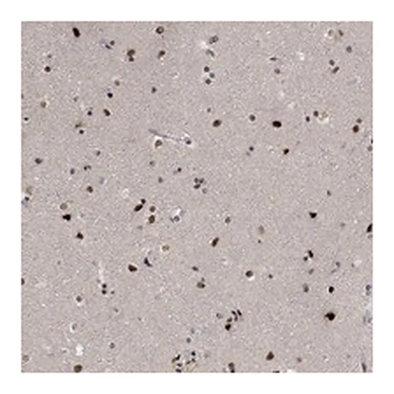 Atlas Antibodies Anti-E4F1 Antibody