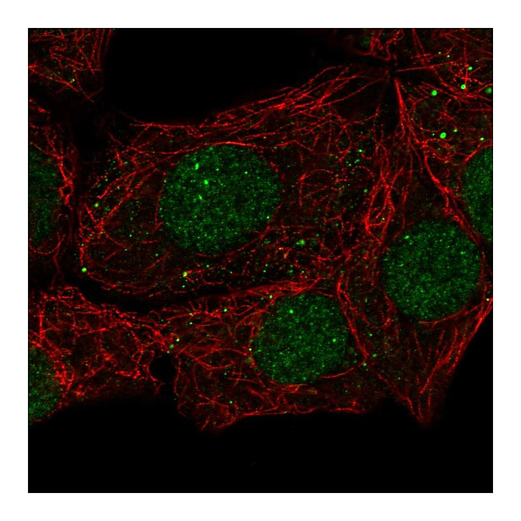 Atlas Antibodies Anti-EAF1 Antibody