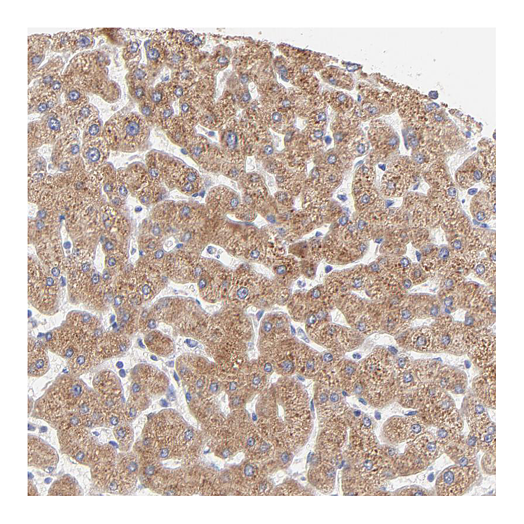 Atlas Antibodies Anti-EBP Antibody