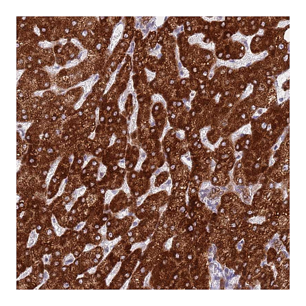 Atlas Antibodies Anti-EBPL Antibody